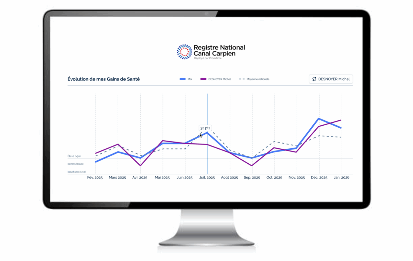 Mockup canal carpien