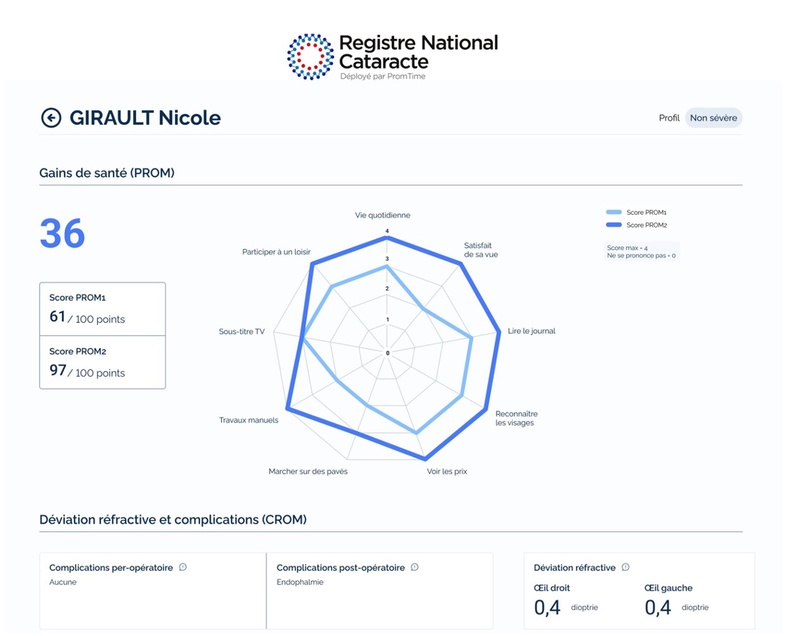 spider-chart-ophtalmo